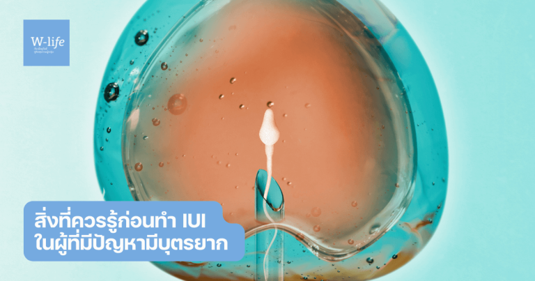การทำ iui
