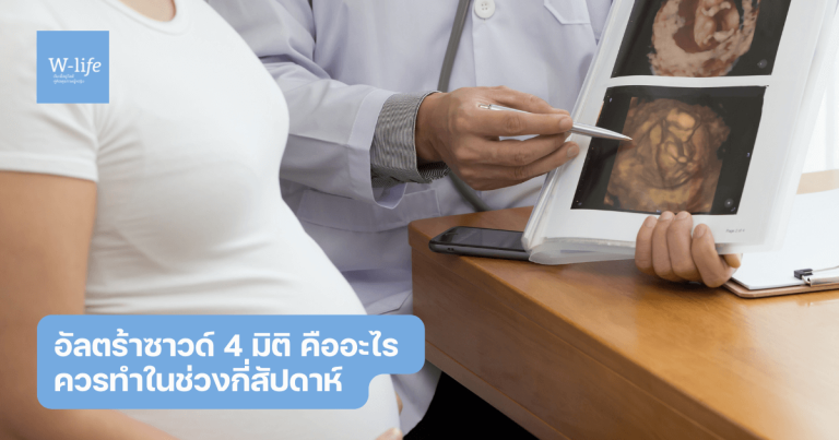 อัลตร้าซาวด์ 4 มิติ