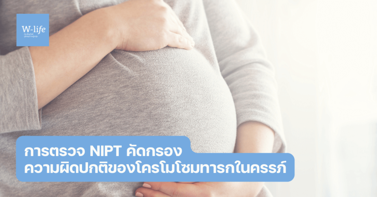 ตรวจ NIPT